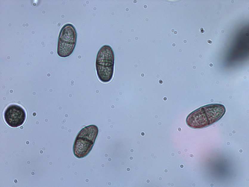병원균(병포자)