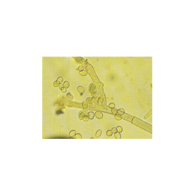 병원균(분생자경 및 분생포자)