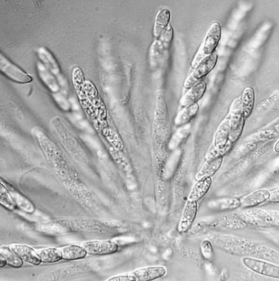 병원균(자낭과 자낭포자)