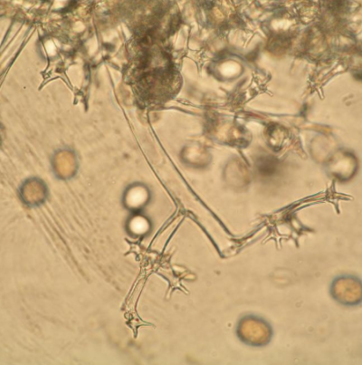 분생자경 및 분생포자