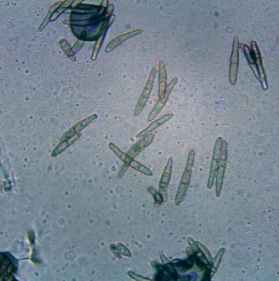 땅콩 검은무늬병 병원균 분생포자