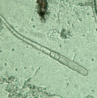 참깨 잎마름병 병원균 A. longgissima 분생포자
