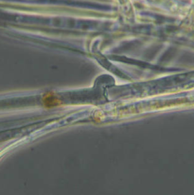 감자 흰비단병 병원균 균사