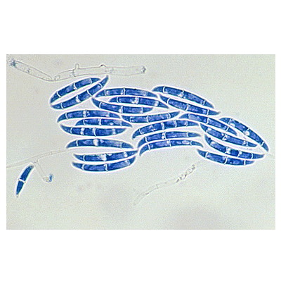감자 마른썩음병 병원균 분생포자