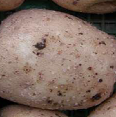 피목 비대 증상