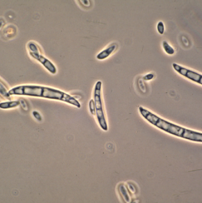 고구마 덩굴쪼김병 병원균 분생포자