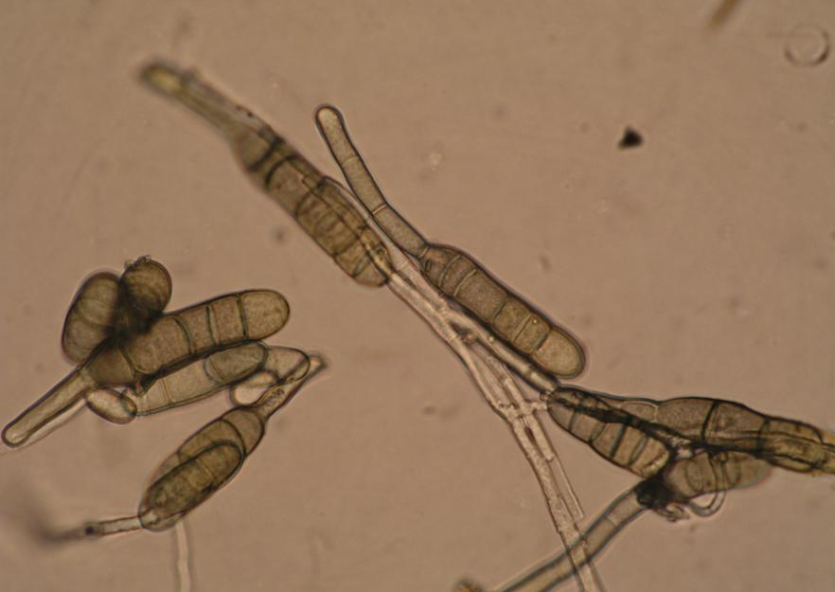 귀리 줄무늬병 병원균 분생포자