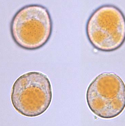 귀리 좀녹병 병원균 하포자