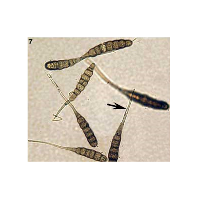 감자 겹둥근무늬 병원균 분생포자