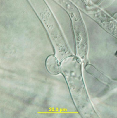 고구마 둥근무늬병병원균 균사 접합 꺽쇠연결