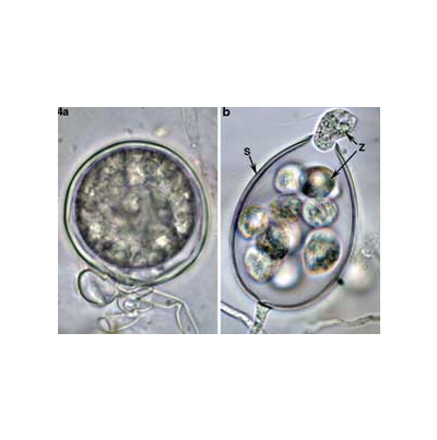 감자 홍색부패병 병원균 난포자와 유주자낭