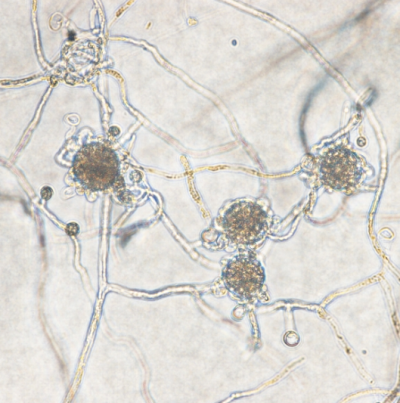 감자 줄기기부썩음병 병원균 난포자