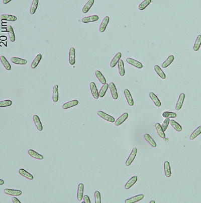 녹두 탄저병 병원균 분생포자