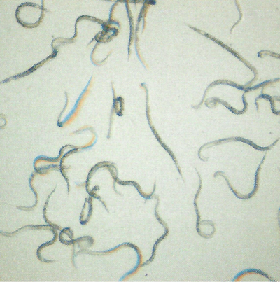 뿌리혹선충 유충