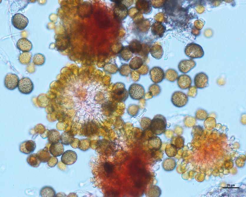 귀리 깜부기병 병원균 (U. nuda)