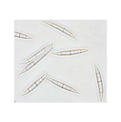 고구마 표피썩음병 병원균 대형포자