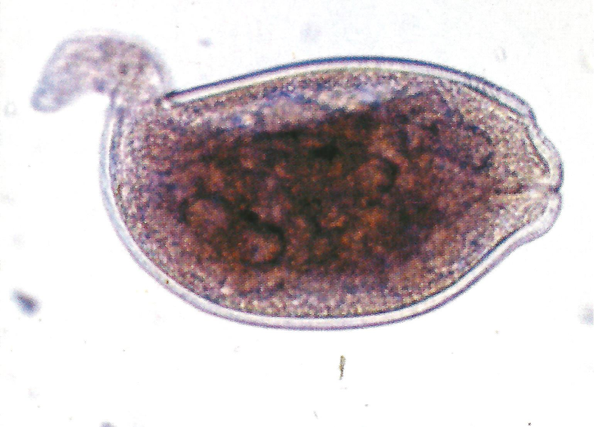 뿌리혹선충 암컷 성충