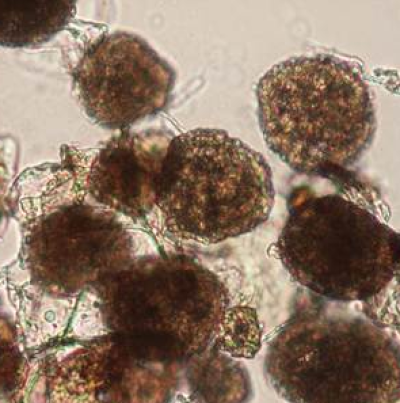 감자 가루더뎅이병 병원균 포자낭