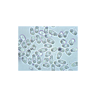 고구마 점무늬병 병원균 (Phoma sp.)