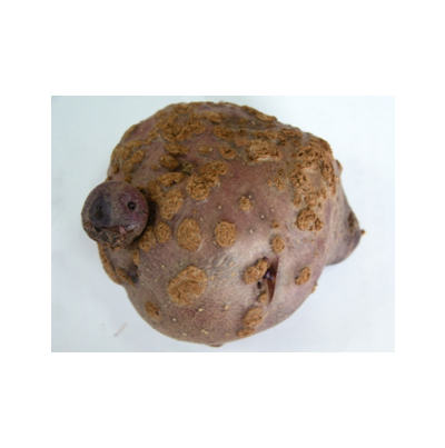 감자 더뎅이병 융기형 증상