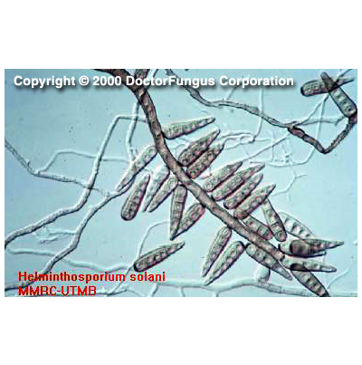 감자 은무늬병 병원균 분생포자