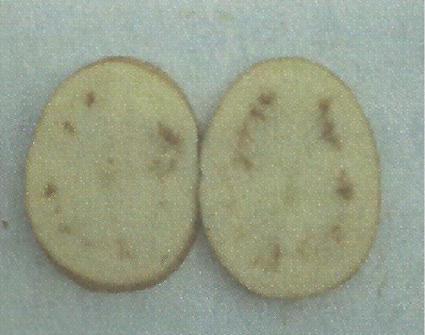 감자 내부갈색반점 피해 증상 2