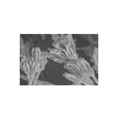 고구마 푸른곰팡이병 병원균 분생포자