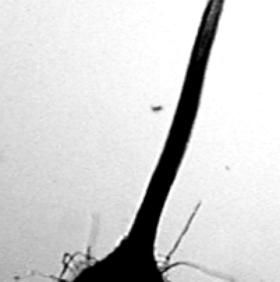 고구마 검은무늬병 병원균 자낭각