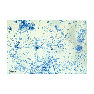 감자 반쪽시들음병 병원균 분생포자