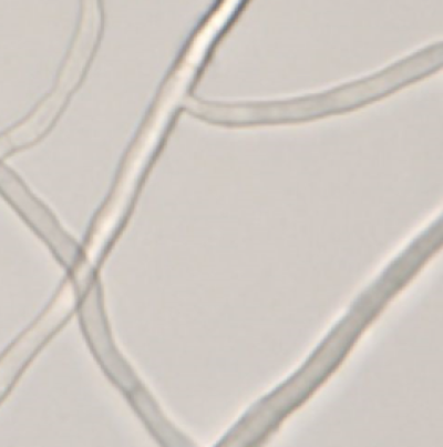 고구마 자주날개무늬병 병원균 균사 접점