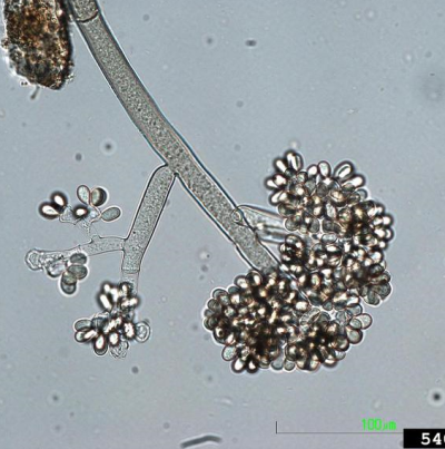 감자 잿빛곰팡이병 병원균 분생포자