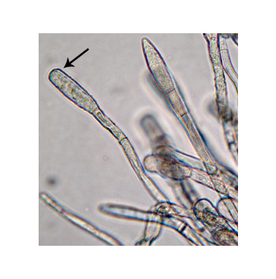 흰가루병 병원균 L. taurica