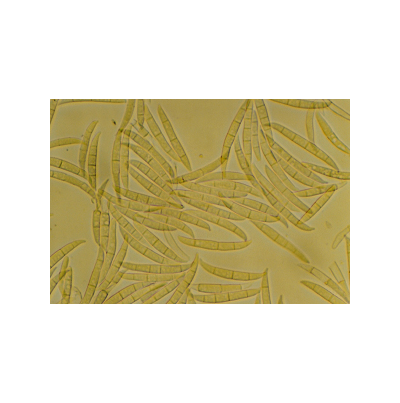 귀리 붉은곰팡이병 병원균 분생포자