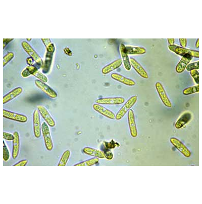 감자 탄저병 병원균 분생포자