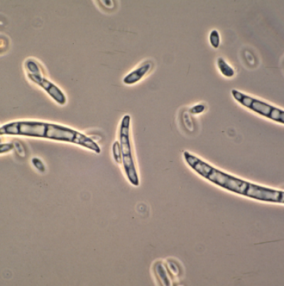 참깨 시들음병 병원균 F. oxysporum 분생포자