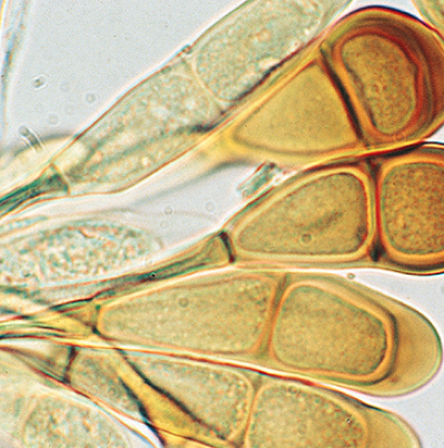 귀리 줄기녹병 병원균 동포자