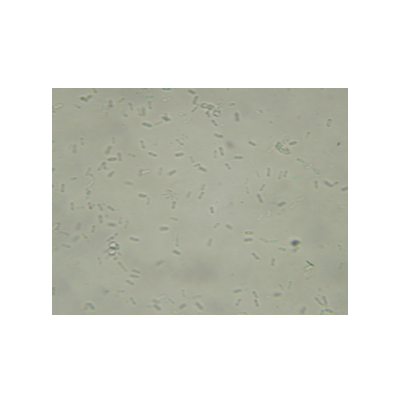 땅콩 그물무늬병 병원균 병포자
