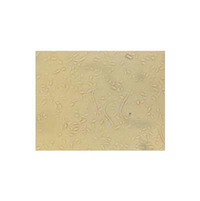 병원균(병포자)