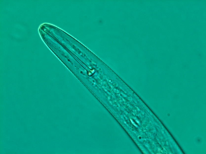 성충의 머리 형태