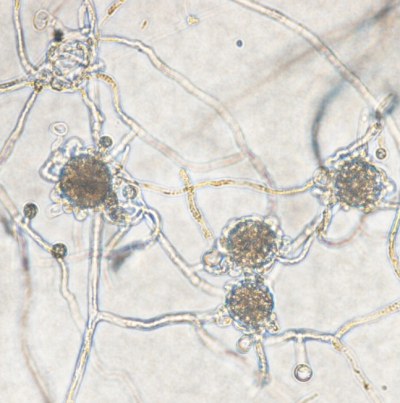 병원균(난포자)