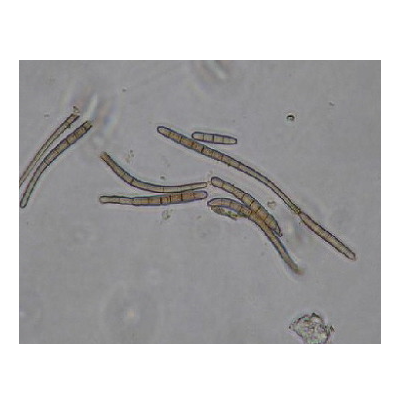 병원균(분생포자)
