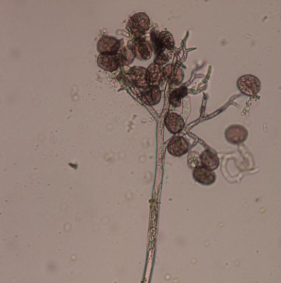 병원균(분생포자경 및 분생포자)