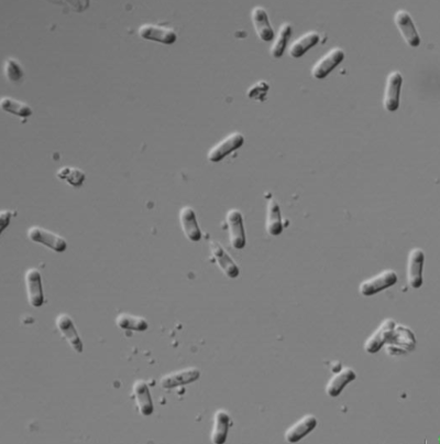 병원균(병포자)
