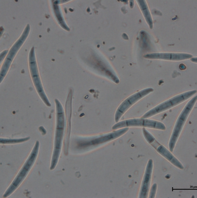 병원균(분생포자)