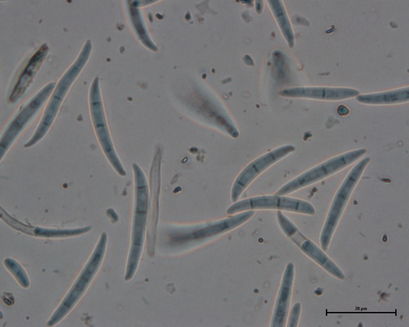 병원균(분생포자)
