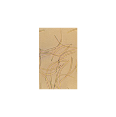 병원균(병포자)