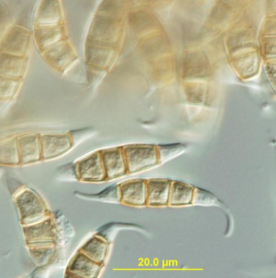 병원균(분생포자)