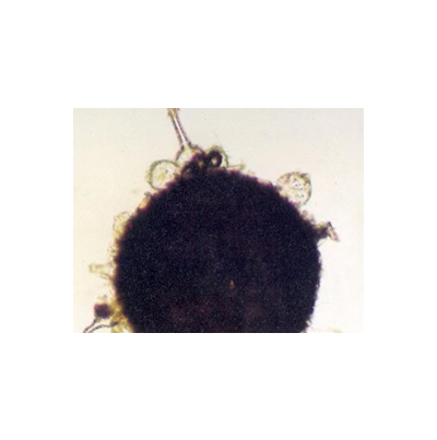 병원균(자낭각)