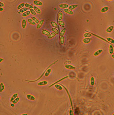  병원균(α 및 β 병포자) 