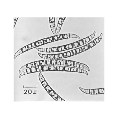 병원균 분생포자(F. decemcelluare)